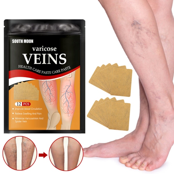 VEINPAT