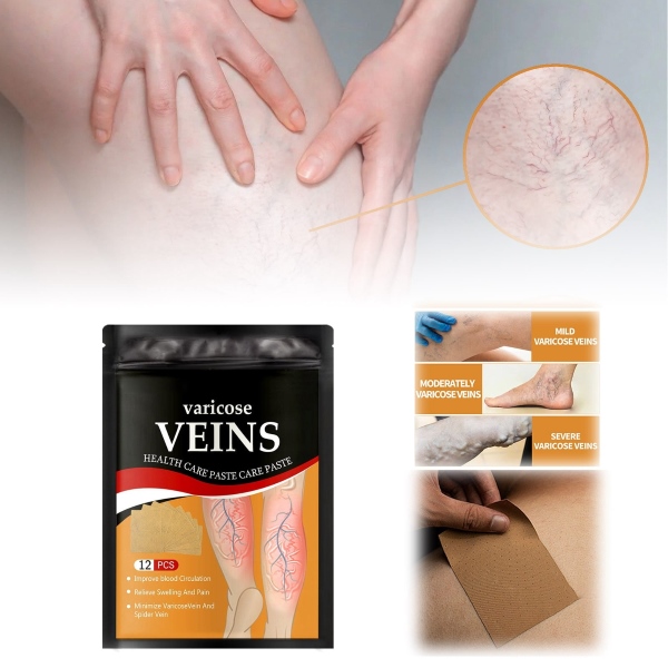 VEINPAT